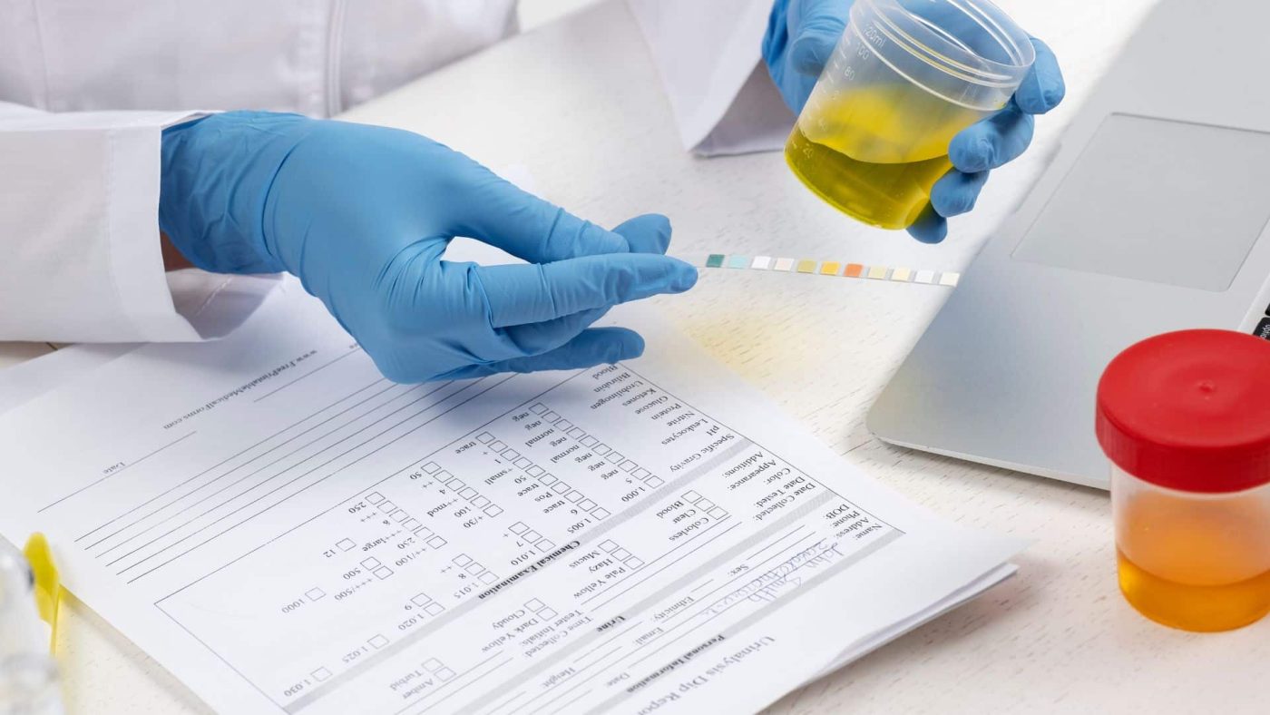 What Does Adipex Show Up As on a Drug Test